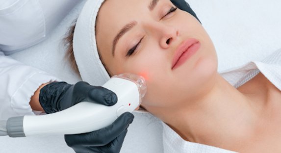 LASER HAIR TREATMENT